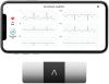 Image Moniteur ECG Personnel connecté AliveCor KardiaMobile 6L